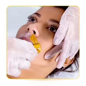 Epilação do Buço
